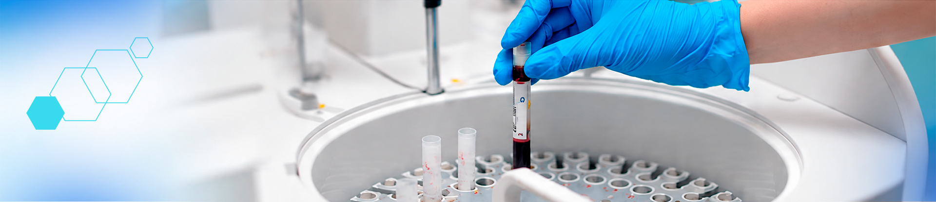 Personal de laboratorio procesando una muestra